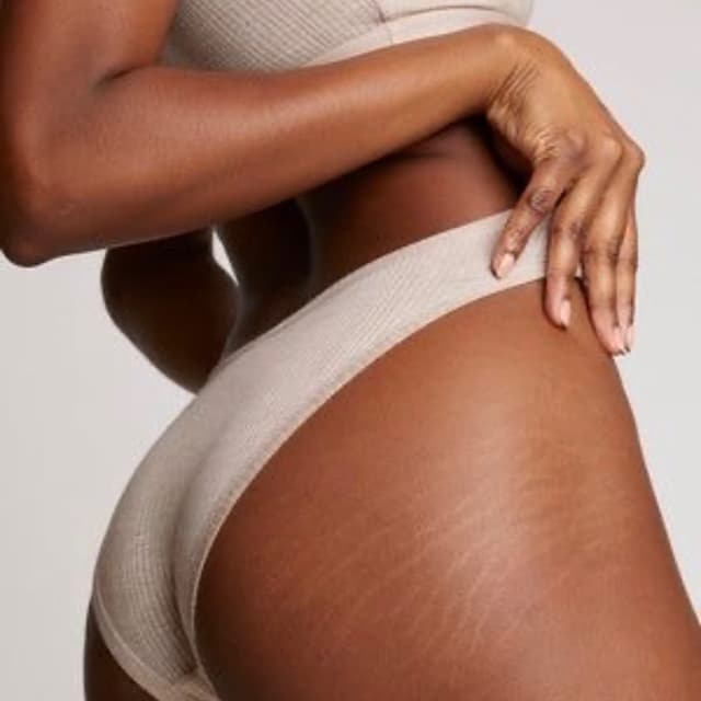 Full Body Sculpting  Package at HealHer Body Sculpting in Albuquerque, NM